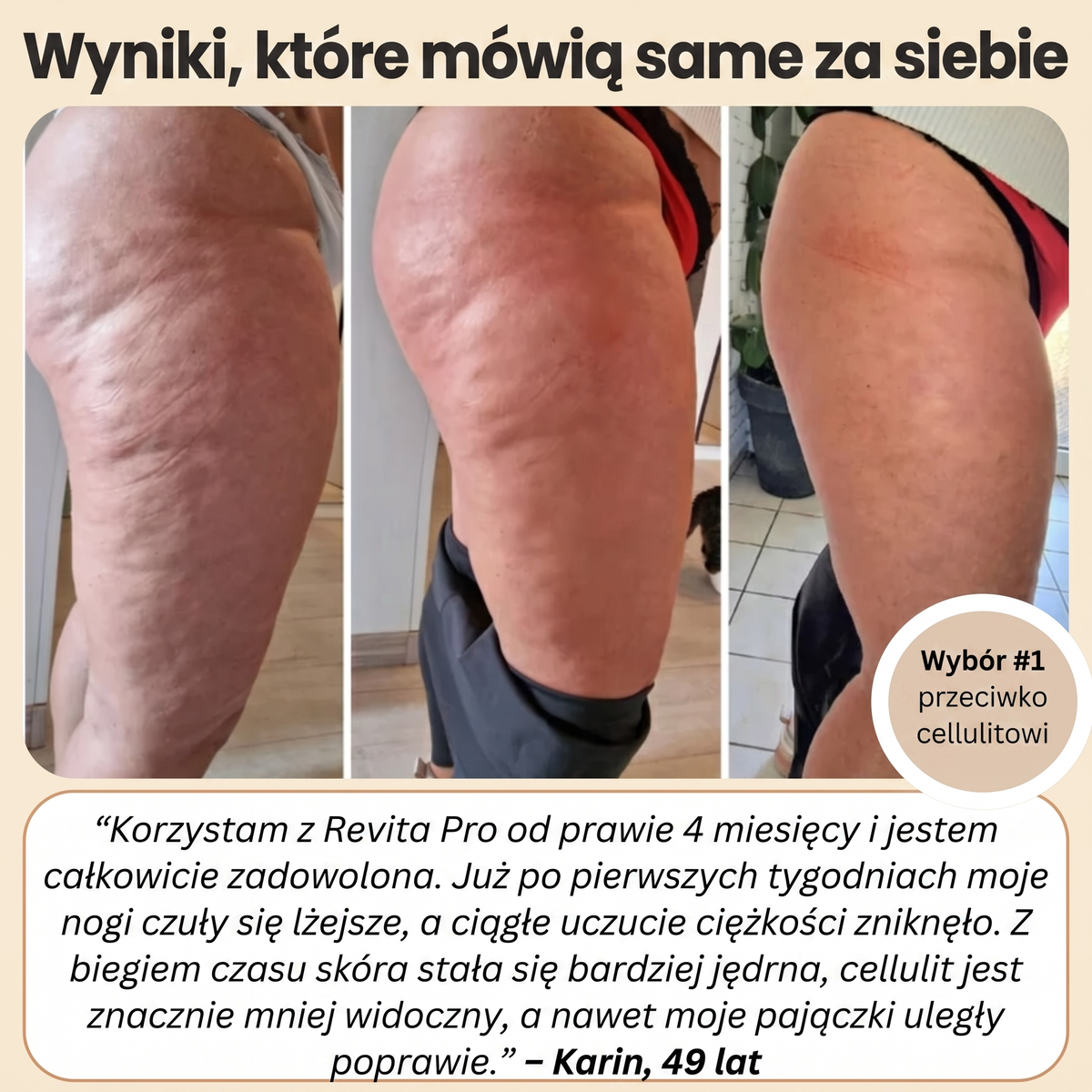 FEMILLIE PRO – legginsy kompresyjne z efektem spalania kalorii i ujędrniania skóry